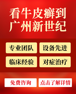 红皮病型牛皮癣可以多年不复发吗